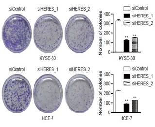 이상길 교수 연구팀은 KYSE-30, HCE-7 두 암세포 군락에 HERES를 억제한 결과 암세포 군락이 현저히 줄어 HERES가 암세포 증식에 관여한다는 사실을 확인했다. (그림=세브란스병원)