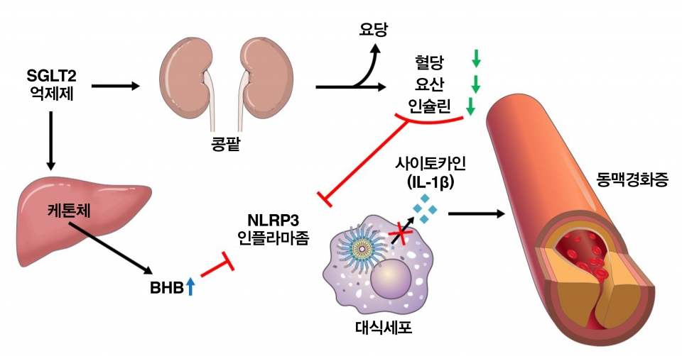 SGLT2 억제제는 콩팥을 통해 요당을 배출하도록 도와 혈액 내 포도당과 요산, 인슐린 수치를 낮춰 NLRP3 인플라마좀 활성을 억제한다. SGLT2 억제제는 또, 간에서 케톤체를 생성해 혈액 내 β-하이드록시부티르산(BHB)을 증가시켜 NLRP3 인플라마좀을 억제하는 것으로 이번 연구에서 밝혀졌다. 억제된 NLRP3은 대식세포내 사이토카인의 생산을 줄이는 것으로 확인됐다. 사이토카인은 죽상동맥경화증을 유발한다.