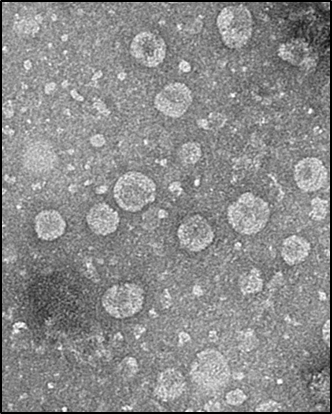 전자현미경으로 촬영한 녹차유산균 엑소좀(L. plantarum exosome)