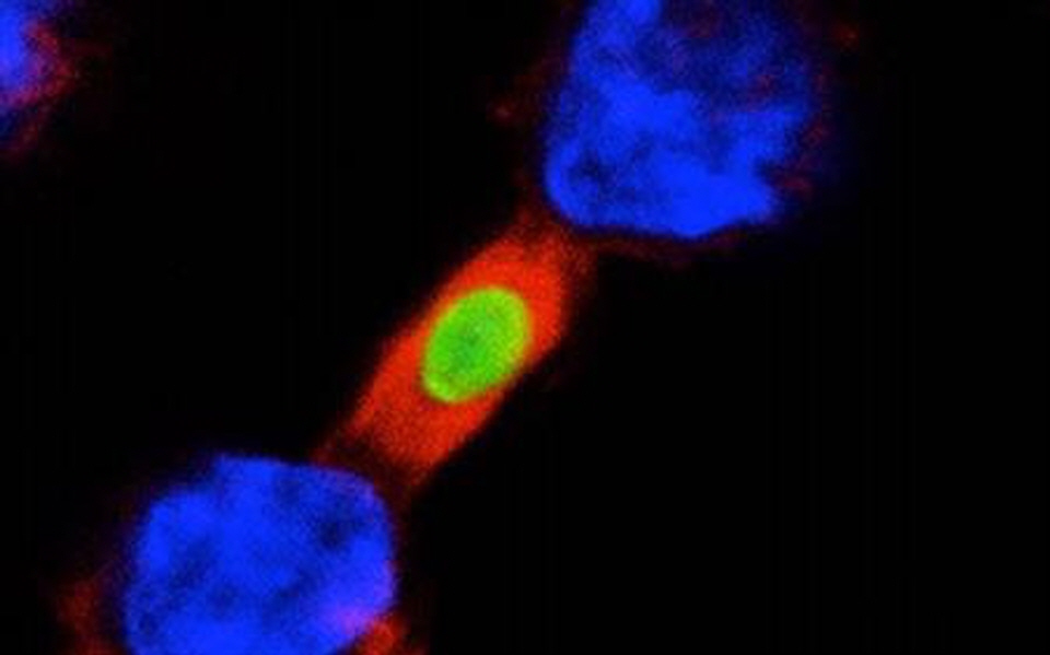두 개의 대식세포(파란색)가 같은 병원체(녹색)를 집어삼키기 위해 싸우고 있다. 이 중 빨간색이 GIV 유전자 (사진=미국 캘리포니아 샌디에이고 의과대학)