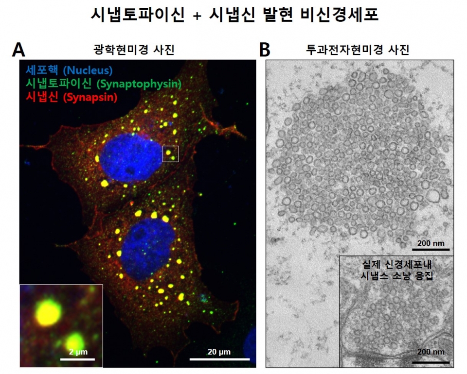 (그림 1) 시냅토파이신과 시냅신에 의한 액체-액체 상분리 현상 및 비신경세포에서의 시냅스소낭 응집 모사 구조 형성(A) 비신경세포에 시냅토파이신과 시냅신을 발현시킨 후 광학현미경으로 관찰한 사진 (파랑: 세포핵, 초록: 시냅토파이신, 빨강: 시냅신). 세포내에서 동그랗게 뭉친 액체-액체 상분리현상을 볼 수 있다. (B) 단일 액체-액체 상분리현상을 투과전자현미경으로 본 모습. 하단의 실제 신경세포에서 관찰되는 것과 유사한 소낭들의 응집구조를 비신경세포에서 재현하였다.