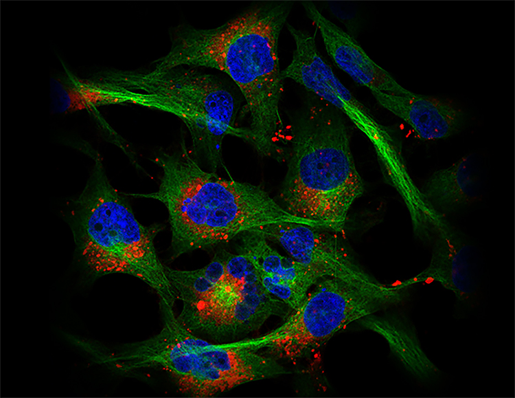 CDV의 세포 내 흡수에 대한 공초점 현미경 이미지(빨간색:CDV, 녹색:세포질, 파란색:세포핵).UCMSC-CDV가 BT549 세포 내에 효과적으로 흡 수됨을 알 수 있다.