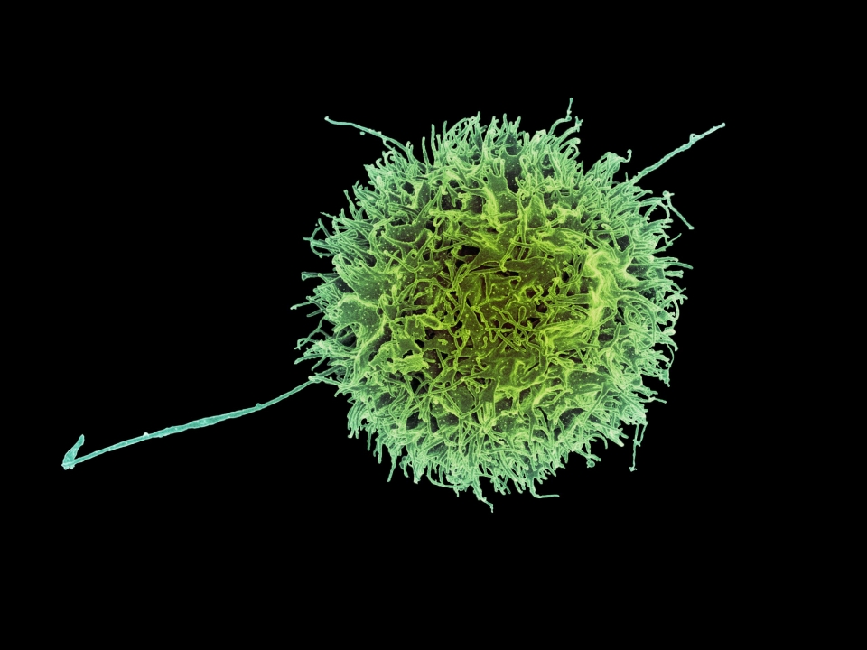 NK(자연 살해, Natural Killer) 세포 [사진=미국 보건부 산하 국립 알레르기·전염병 연구소(NIAID)]