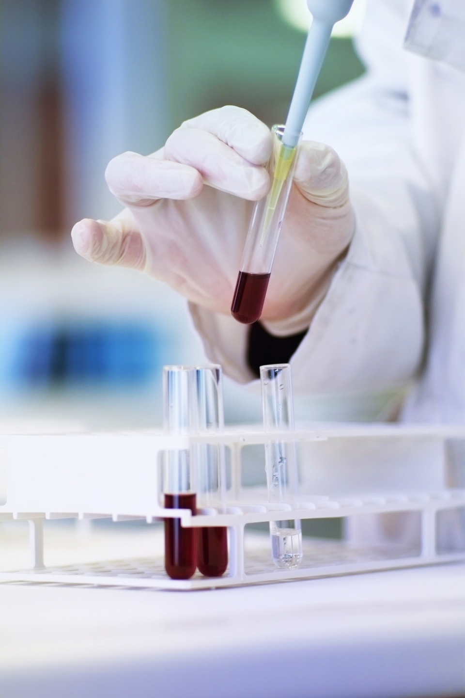 연구개발, R&D 시험 실험 화학 제약 의약