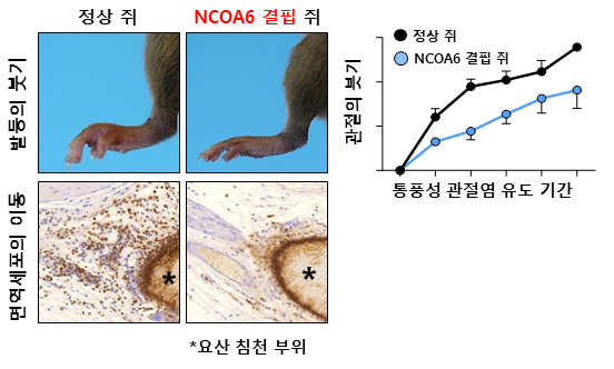 NCOA6 유전자가 결핍된 생쥐에서 통풍성 관절염이 감소됨