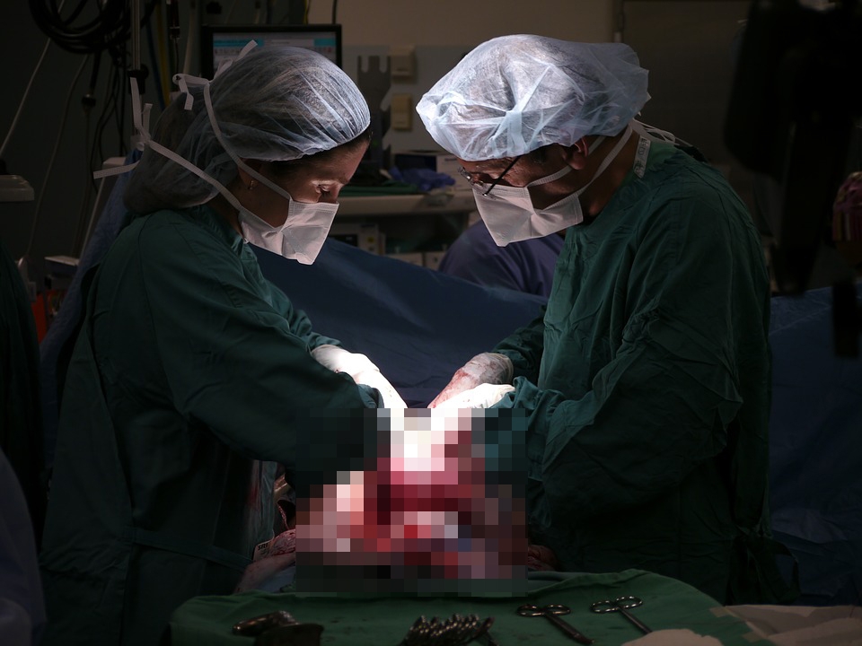미국의 한 산부인과에서 제왕절개 분만수술을 하고 있다.