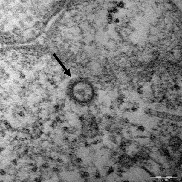 질병관리본부가 공개한 코로나19 바이러스 고해상도 전자현미경 사진. (사진=질병관리본부)