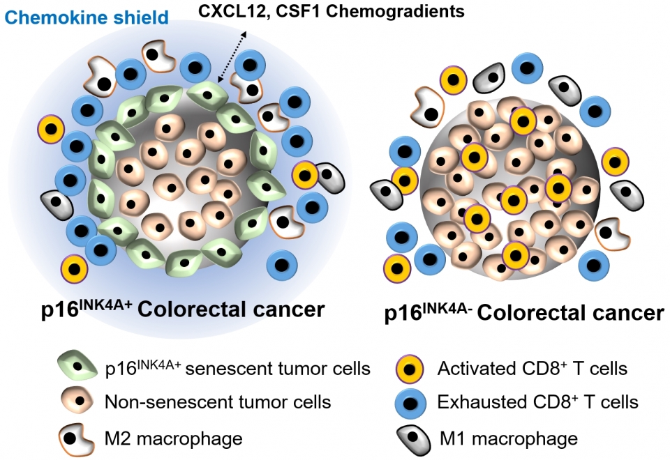 대장암의 종양 면역 억제 과정에서 노화종양세포의 역할대장암에서 종양의 침윤이 일어나는 변연부에서 많이 관찰되는 노화종양세포는 다양한 분비체를 통해 종양 면역억제에 관여한다. 특히 사이토카인 중 하나인 CXCL12과 CSF1은 종양 면역에 중요한 세포독성 T 세포의 종양 내 침투를 억제하고 기능을 저하시켜 T 세포들의 공격으로부터 암세포들을 보호하는 역할을 하여 암의 진행에 도움을 준다.그림 및 그림설명 제공 : 아주대학교 의과대학 박태준 교수