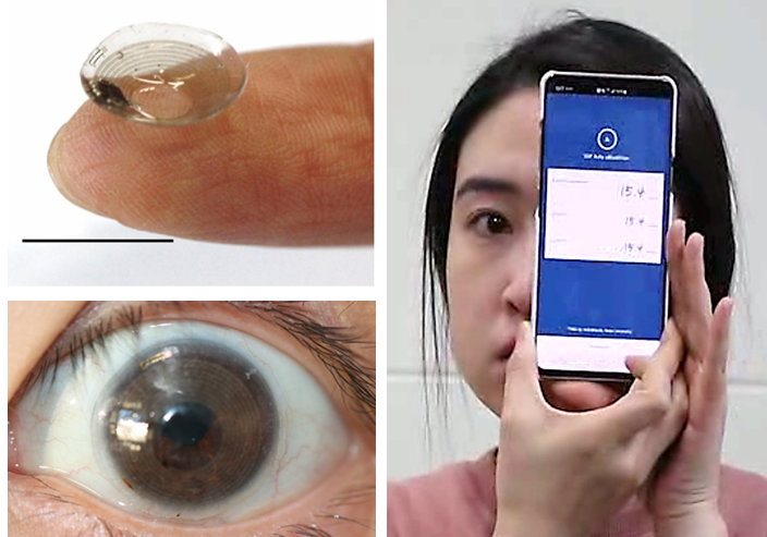 녹내장 무선 모니터링용 스마트 콘택트렌즈(왼쪽) 제작된 스마트 콘택트렌즈의 사진(오른쪽) 제작된 스마트 콘택트렌즈를 사람이 착용한 상태에서의 구동 사진 