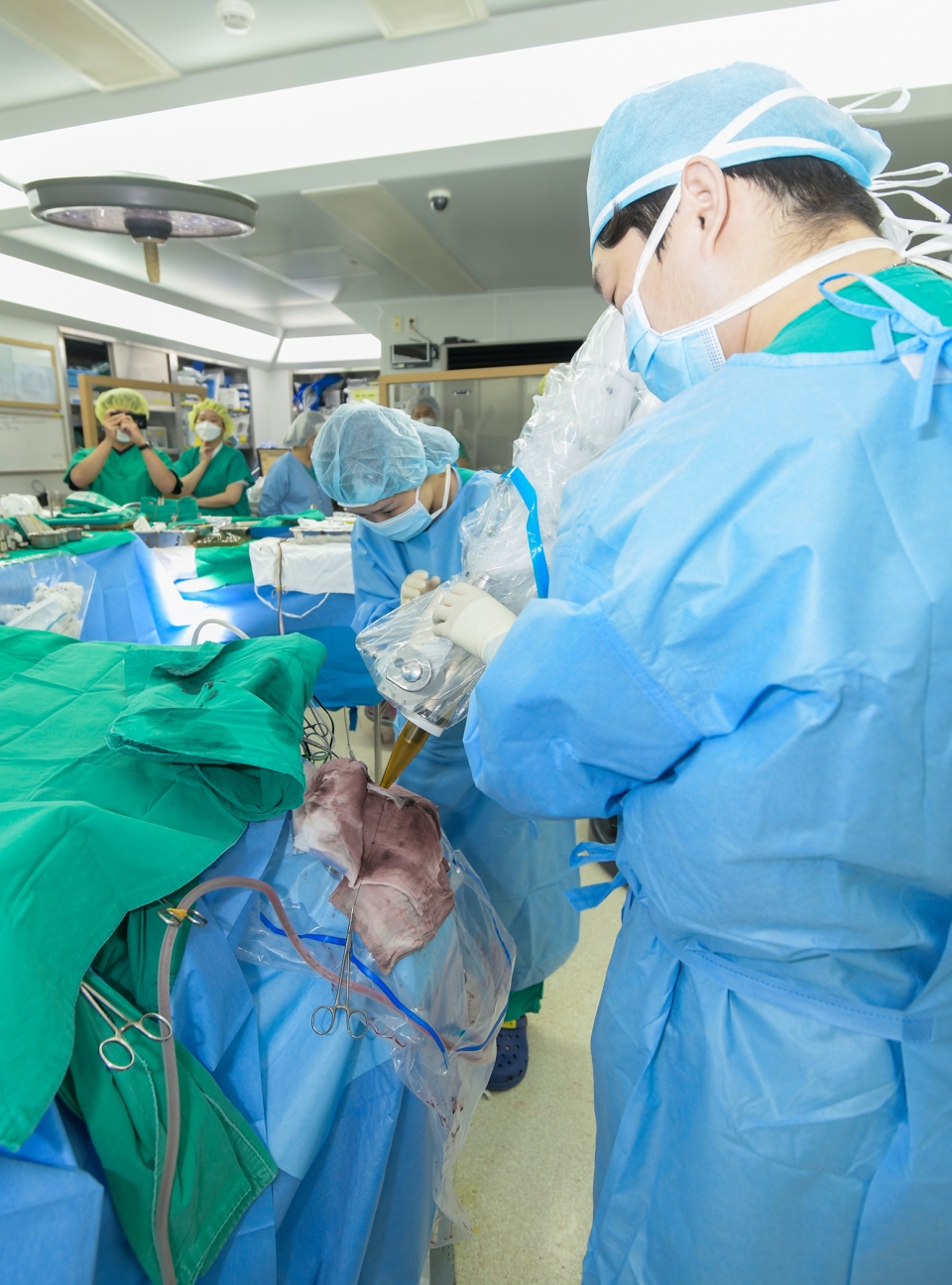 강남세브란스병원 의료진이 교모세포종 환자에 IORT 적용한 수술을 진행하고 있다.