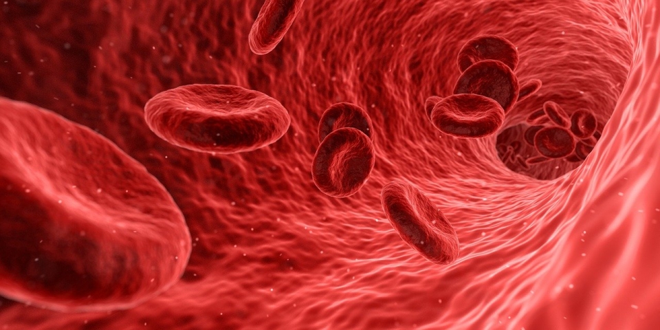 정맥 혈전색전증은 정맥에서 생성된 혈전이 혈관을 막는 질병을 말한다. [사진=Pixabay]