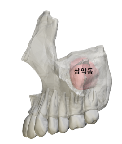 상악동은 윗턱과 뼈와 뺨 사이 코 양옆으로 뼈가 비어있는 공간이다. [사진=서울성모병원 제공]