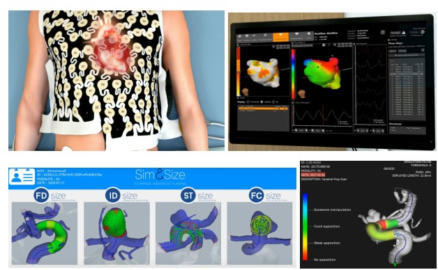 환자의 인체 일부 시뮬레이션 예시(심장, 뇌혈관) [사진=Medtronic, Sim&Cure 홈페이지]