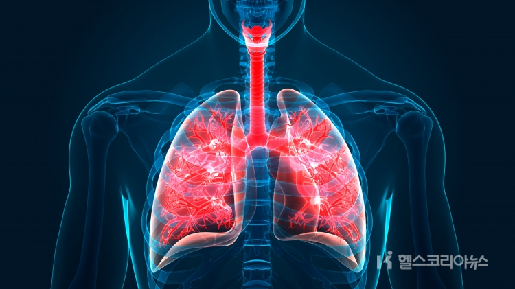 미세먼지 농도가 증가하면 만성폐쇄성폐질환(COPD) 등 호흡기질환이 급속히 악화되는 경우가 많다.