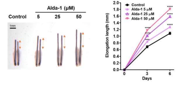 인간 모낭 기관배양 모델에서 ALDH2 활성화제(Alda-1) 처리 후 성장한 머리카락의 길이 비교